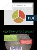 Neuritis Optica de Leber y Inducida Por Farmacos