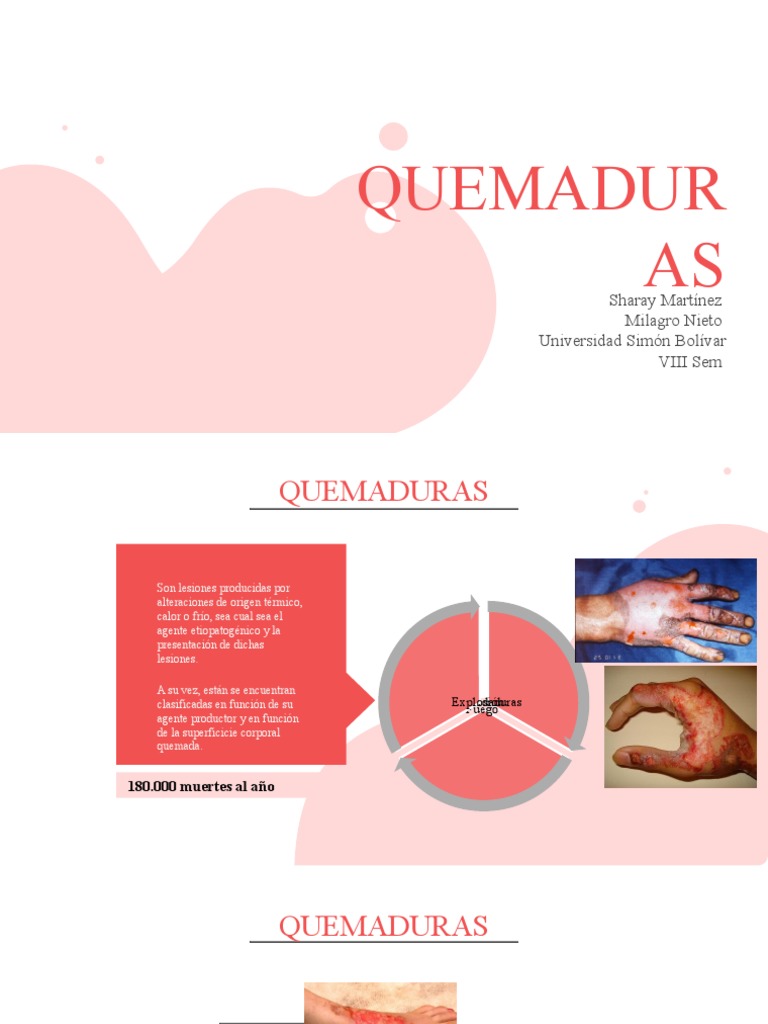 Clasificación y manejo de quemaduras | PDF | Quemar | Piel