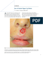 2007 O To Z Reconstruction of Central Upper Lip Defect