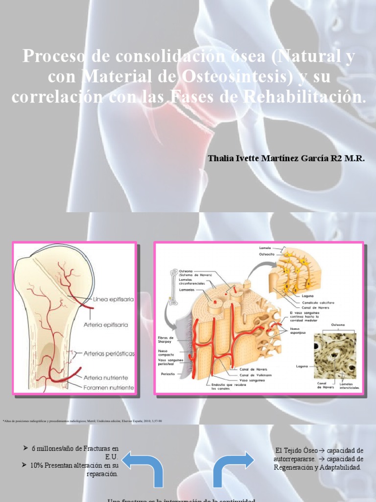 Consolidacion Osea | PDF | Hueso | Traumatologia