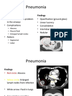 Pneumonia Vs Contusion