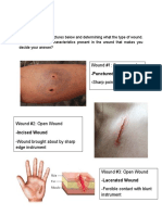 Wound #1: Open Wound - Punctured Wound: - Sharp Pointed Instrument