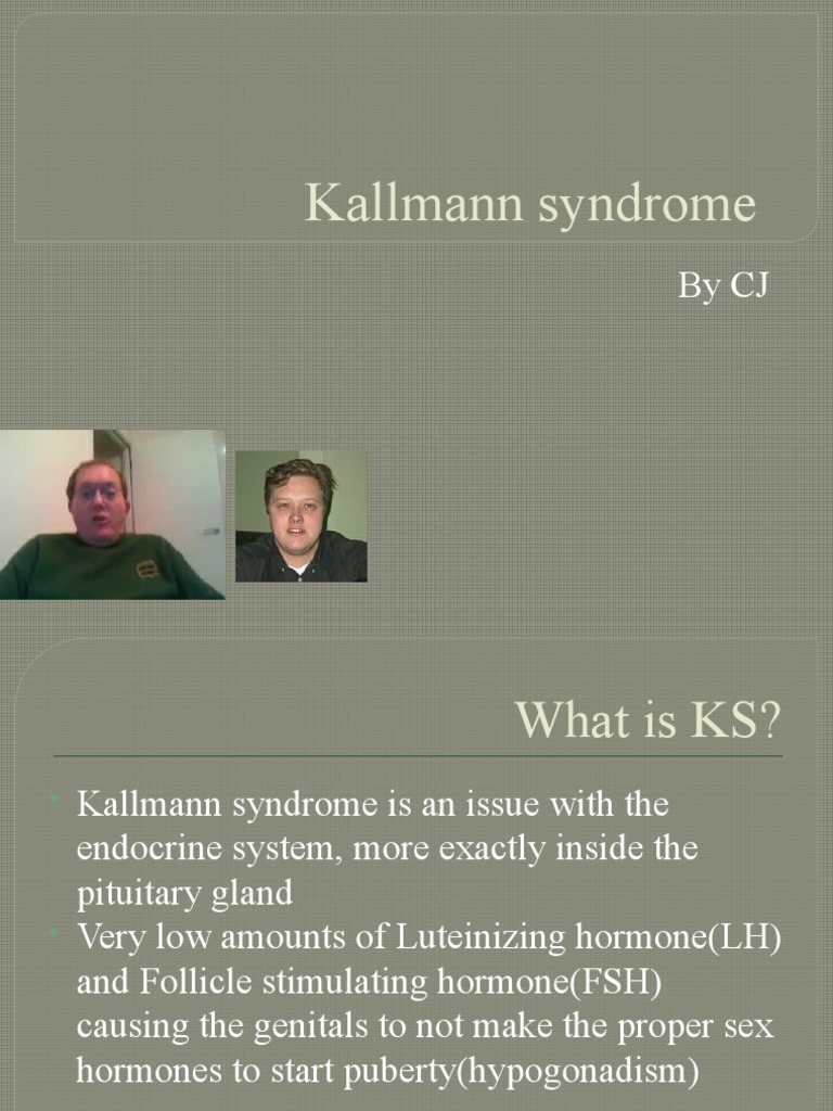 Kallmann Syndrome PDF Luteinizing Hormone Glands
