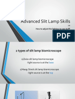 Advanced Slit Lamp Skills: How To Adjust The Lighting To See Stuff!