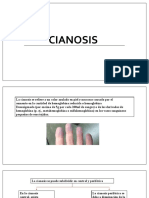 Cianosis Propedeutica