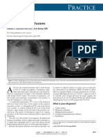 Practice: Bilateral Pleural Effusions