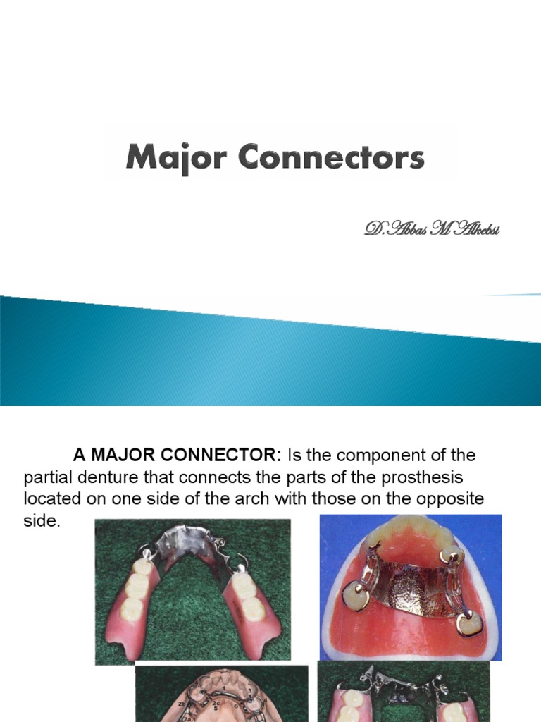 Maxillary and Mandibular Major Connectors | PDF | Animal Anatomy ...