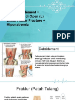 Debridement ORIF Fraktur Distal Femur Kiri + Hiponatremia