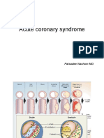 Acute Coronary Syndrome: Patsadee Nachom MD