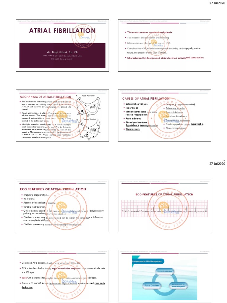 Guidelines for the Diagnosis and Management of Atrial Fibrillation in ...