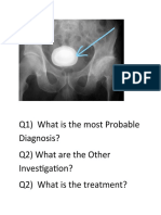 Q1) What Is The Most Probable Diagnosis? Q2) What Are The Other Investigation? Q2) What Is The Treatment?