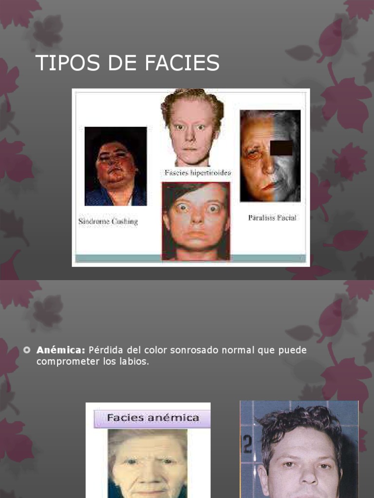 Tiposdefacies 170327014102 PDF | PDF | Enfermedades y trastornos | Rtt, image size:768x1024