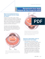 Recuperacion Boca Abajo Despues de Una Cirugia de Retina PDF