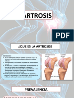 Artrosis: causas, síntomas y tratamiento de la enfermedad articular