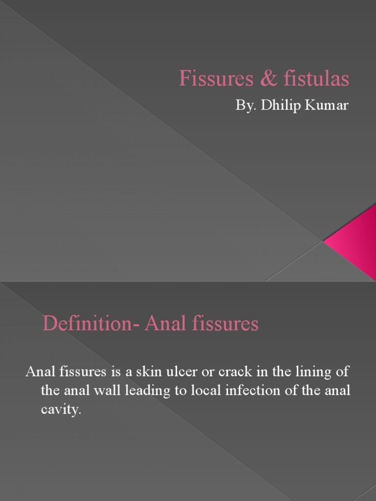 Fissures & Fistulas PDF Constipation Rectum