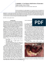 Submandibular Salivary Sialolith: A Case Report With Review of Literature