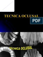 Tecnicas Radiograficas Bite Wing