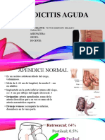 Apendicitis Aguda