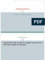 Amputation: by Mr. P. Dhilip Kumar