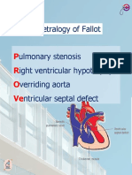 Tetralogy of Fallot Ulmonary Stenosis Ight Ventricular Hypotrophy Verriding Aorta Ntricular Septal Defect