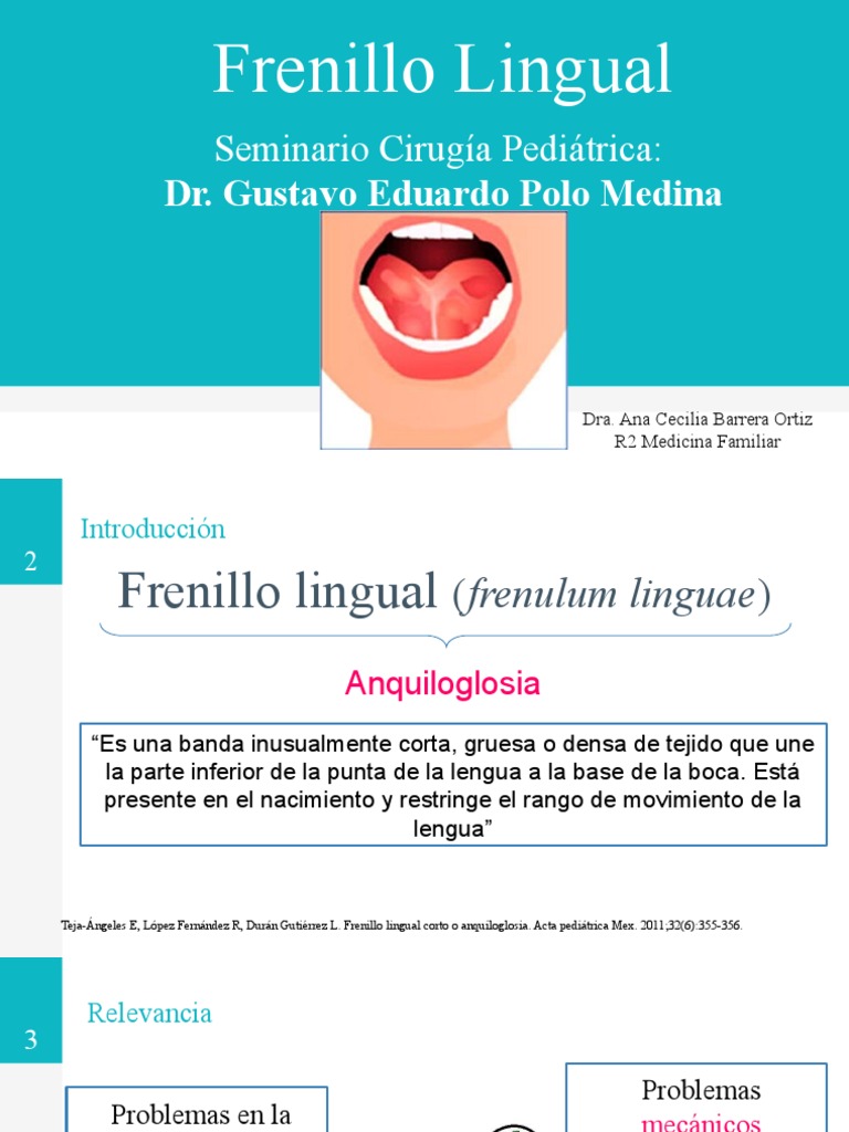 Anquiloglosia PDF Lengua Especialidades Medicas
