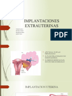 Implantaciones Extrauterinas