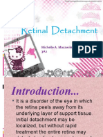 retinal detachment