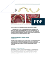 Open-Bite Malocclusion Treatment &Stability 2014 (1)-1-100-61-81-1-20.en.es