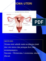 Mioma Uteri