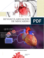 Revascularización de Miocardio