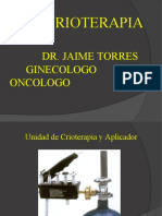 Crioterapia - Dr. Jaime Torres