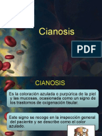 Cianosis