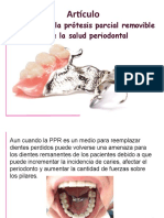 Articulo Efectos de La PPF Sobre La Salud Periodontal