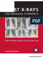 Vietsub - Chest Xrays For Medical Students