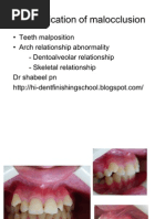 Download Classification of Malocclusion by Shabeel Pn SN47613919 doc pdf