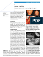 Florid Osseous Dysplasia