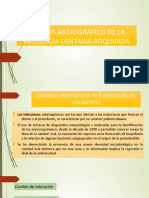 Analisis Radiografico de La Patología Dentaria