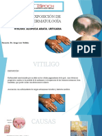 vitiligo (1) (2).pptx