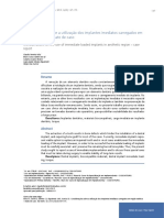 Considerações Sobre A Utilização Dos Implantes Imediatos Carregados em Região Estética - Relato de Caso