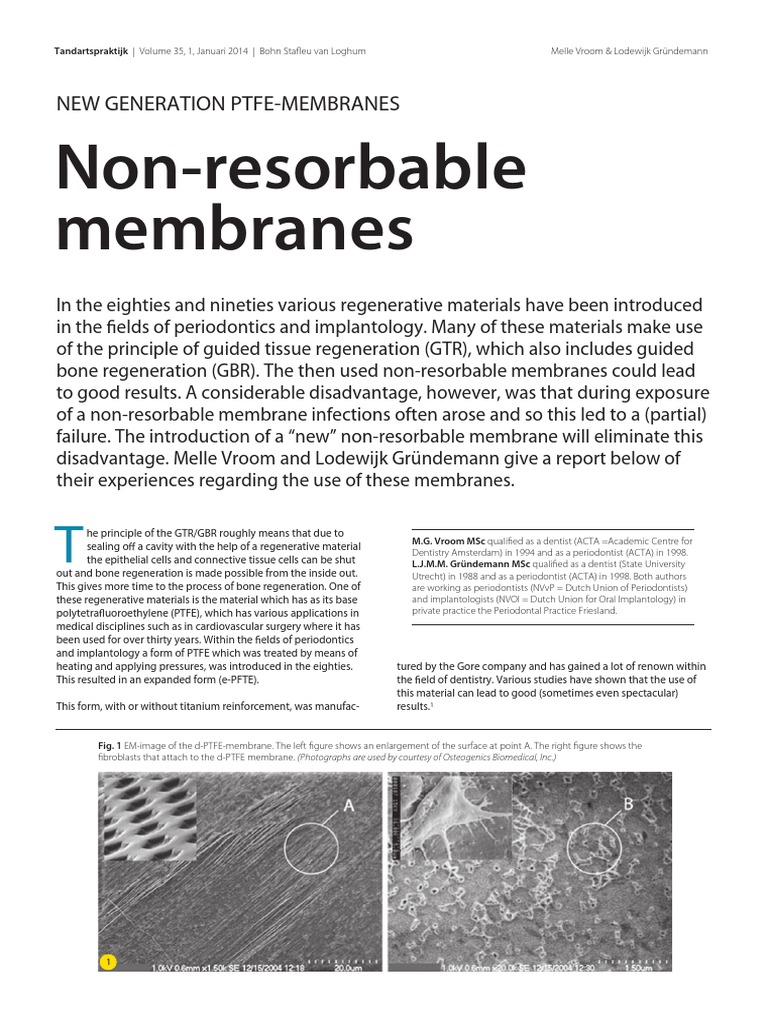 NonResorbable Membranes New Generation PtfeMembranes PDF Dental Implant Periodontology