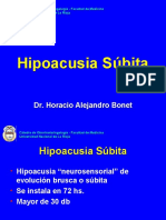Hipoacusia Súbita