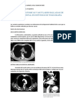 Variantes Anatomicas Vasculares Halladas de Manera Incidental en Estudios de Tomografia Computada