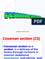 Cesarean Section - DR Rohit Bhaskar