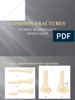 Common Fractures: DR Abdelmoniem Saeed Er Specialist