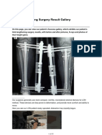 Limb Lengthening Surgery Result Gallery PDF