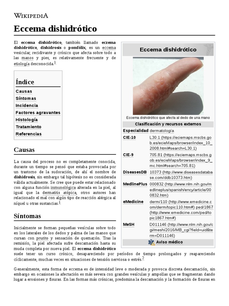 Eccema Dishidrótico Pomada | Eccema dishidrótico: Causas, diagnóstico e ...