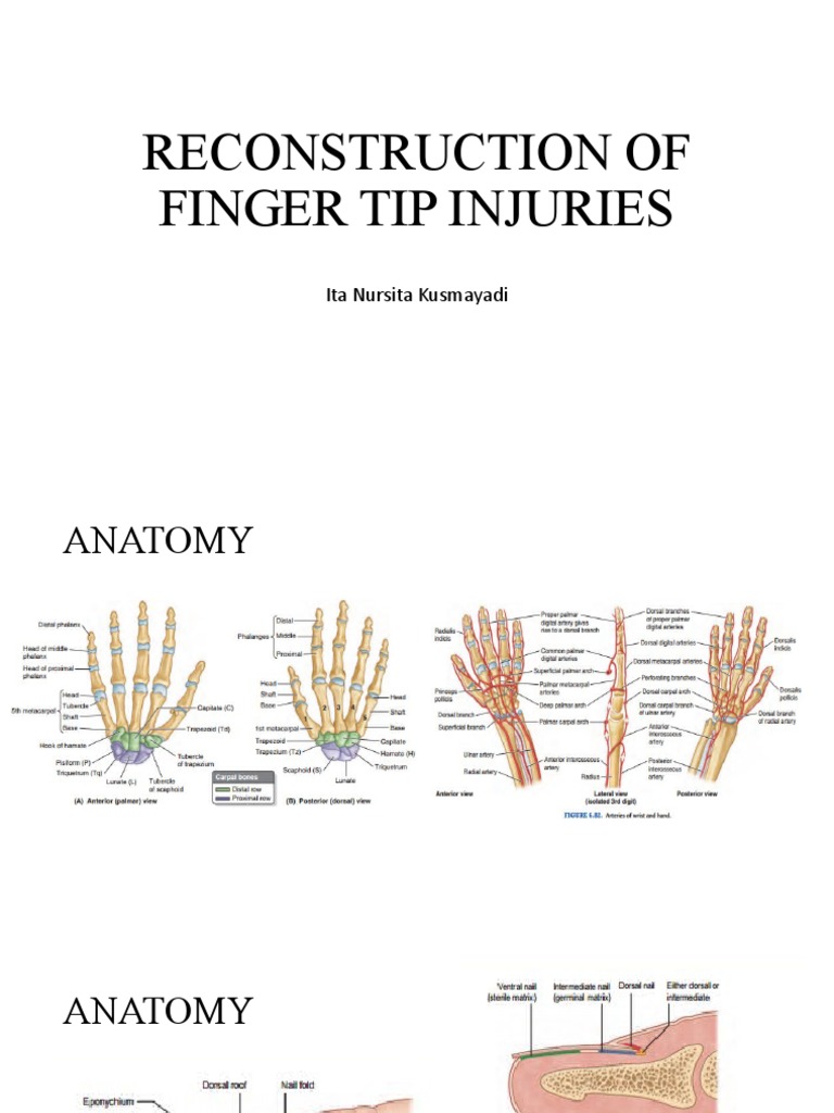 RECONSTRUCTION OF FINGER TIP INJURIES Final PDF Nail (Anatomy) Thumb