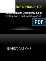 PLID L4-5 e Canal Stenosis