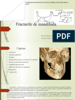 omf.fracturile mandibulare