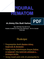 Epidural Hematom